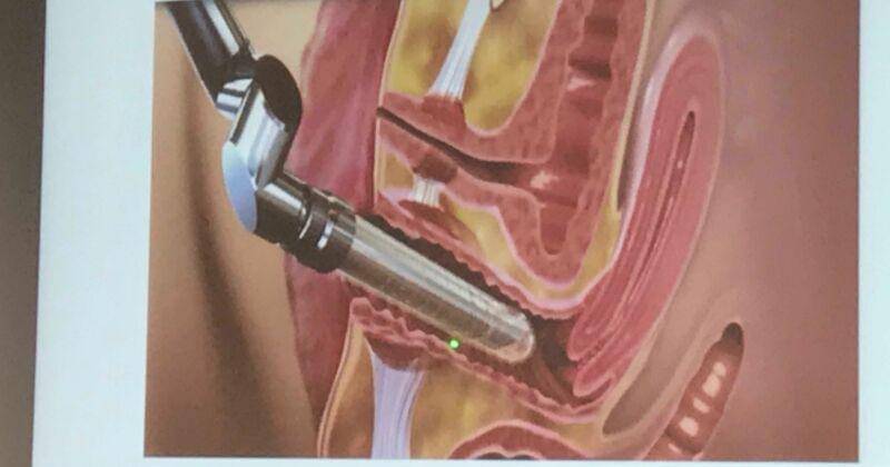 Popmama.com/Ainun Fadhilah